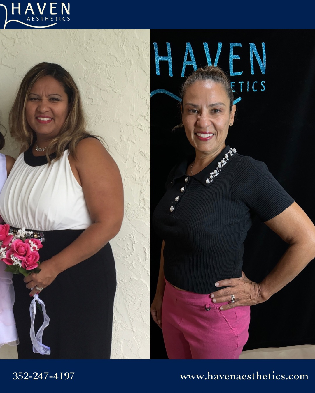 Dr. Otero with a weight loss patient